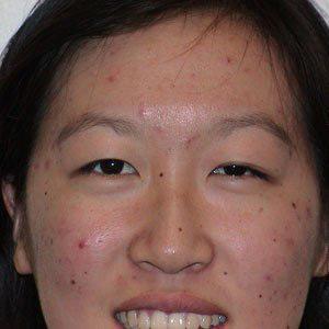 Acne Scar Removal Before & After Patient #66