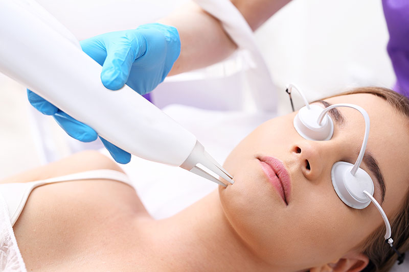 Laser Treatments