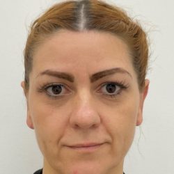 Otoplasty Before & After Patient #3095