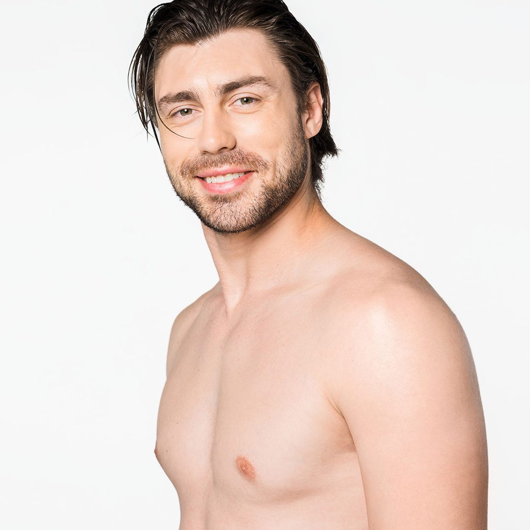 Gynecomastia Alhambra and Santa Ana
