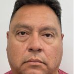 Lower Blepharoplasty Before & After Patient #4044