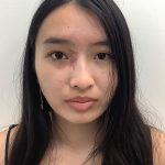 Birthmark Removal Before & After Patient #4031