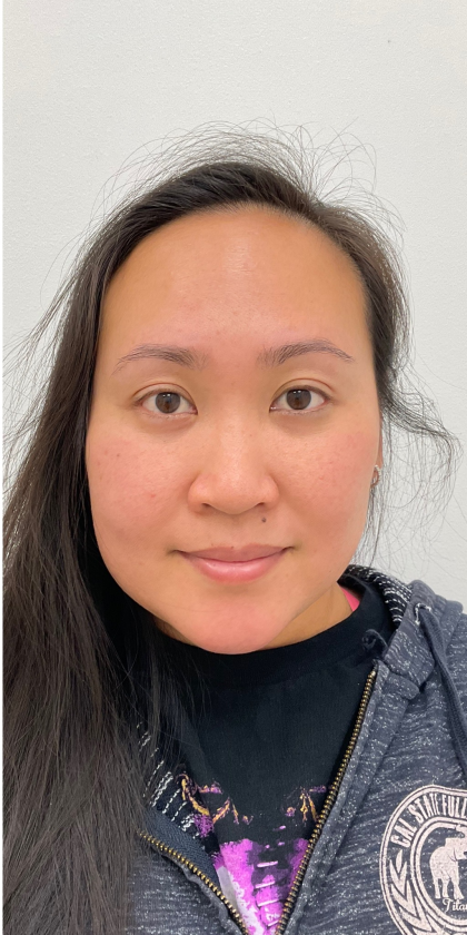 Mole Removal Before & After Patient #4053