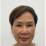 Facial Fillers Before & After Patient #3999
