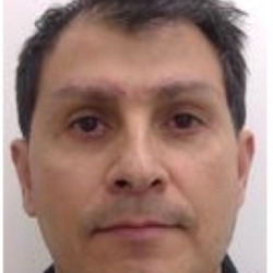 Lower Blepharoplasty Before & After Patient #4156